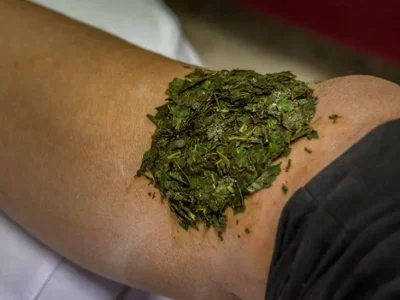 Poultice-Herb-Thai-traditional-medicine-732x549-thumbnail